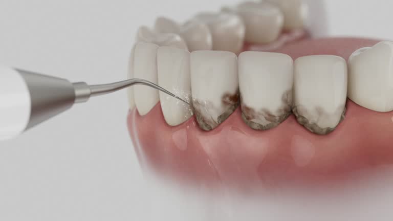 Trusted Dental Implants service in Meadowlakes, TX - Dentist Open Now